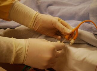 Czy konieczny jest cewnik przy cesarce?